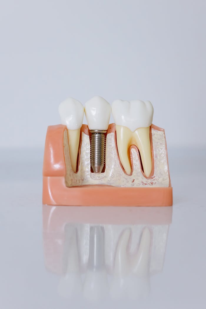 about-04 Detailed view of a dental implant model showcasing teeth and gum anatomy for dental education.