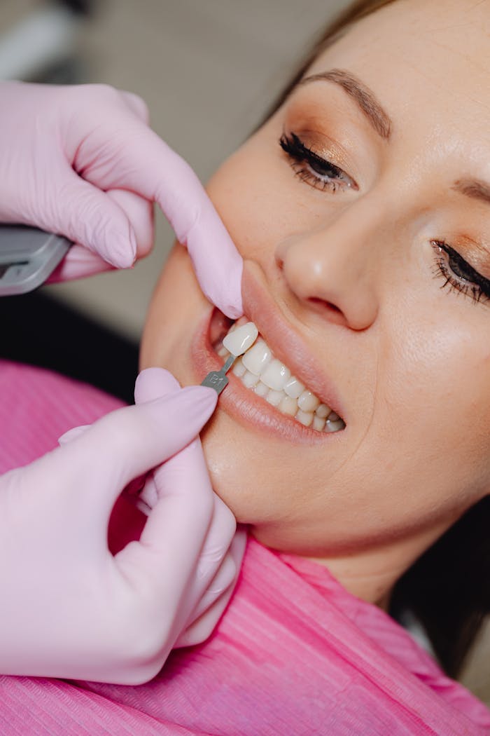 services-03 Detailed shot of a dentist applying veneer to a woman's teeth during a dental procedure.